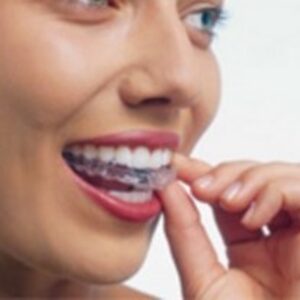 Cosmetic Dentistry Marrickville