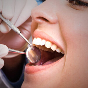 Teeth Whitening Marrickville