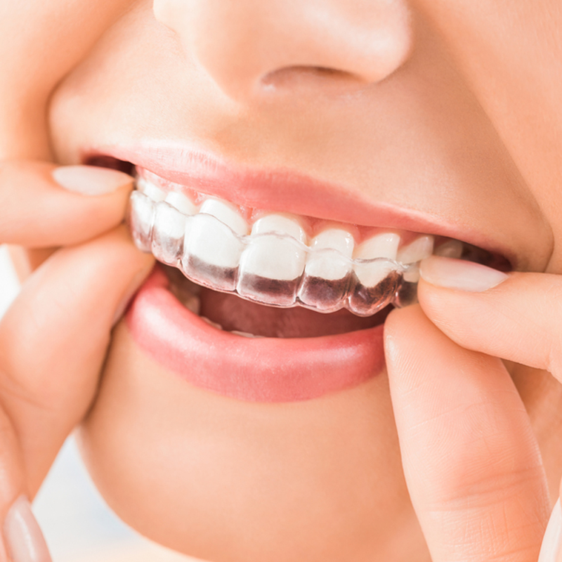 cosmetic dentistry marrickville